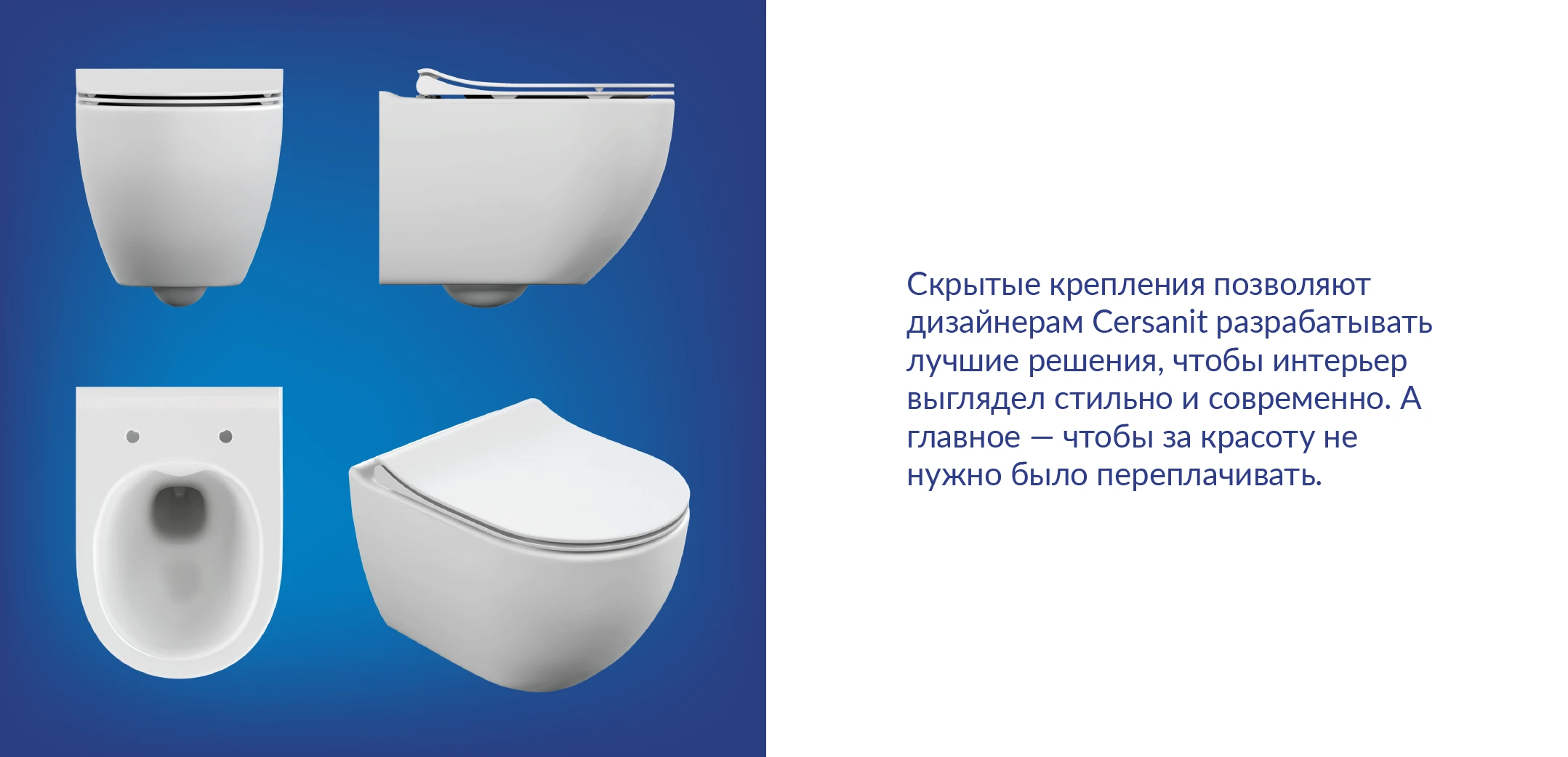 Крепления So Smart: Монтаж за 15 минут